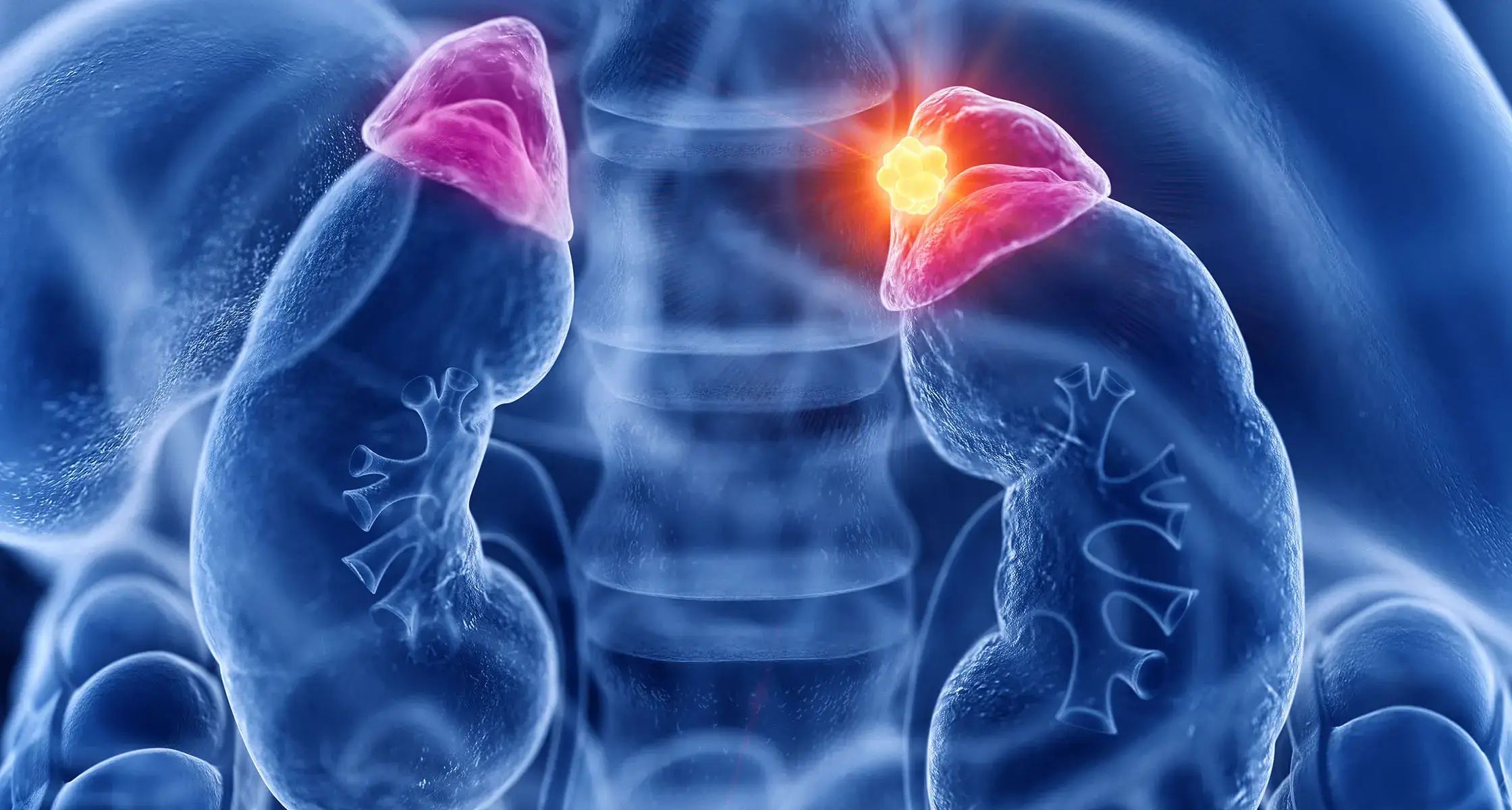 Adrenal Tümörler