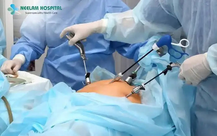 Laparoscopic Surgery