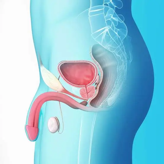 Urethral Stricture